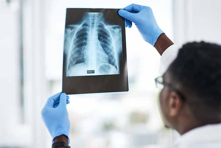 Massey joins new consortium to fight racial inequities in lung cancer