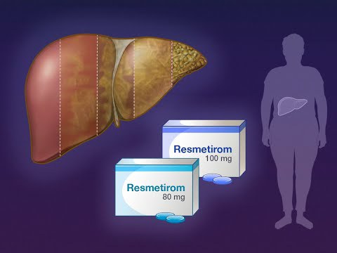 Graphic with liver, boxes of medicine and an outline of a human body