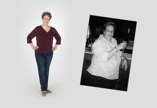 “Recovery was a breeze! I did not take any pain medications after leaving the hospital.” Debra Batchelder, 53, 95 lbs. lost